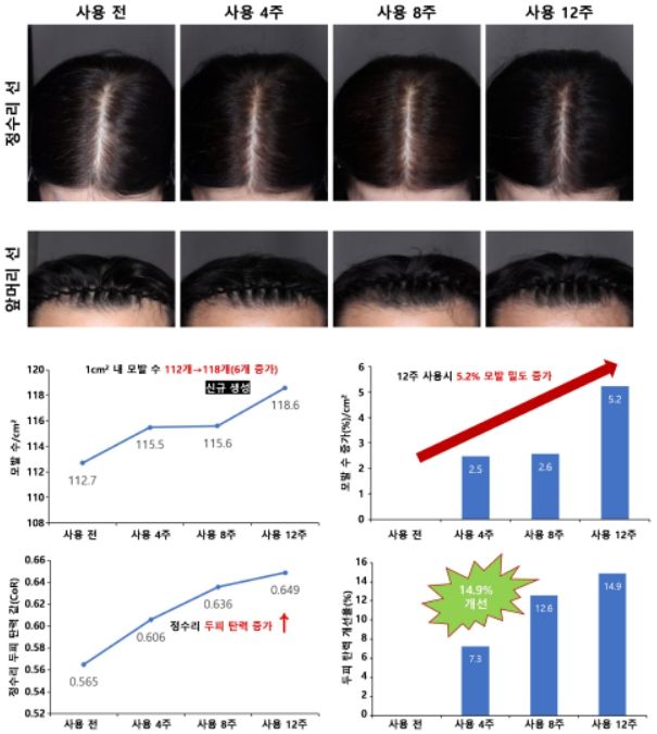 모발 밀도와 두피 탄력 개선